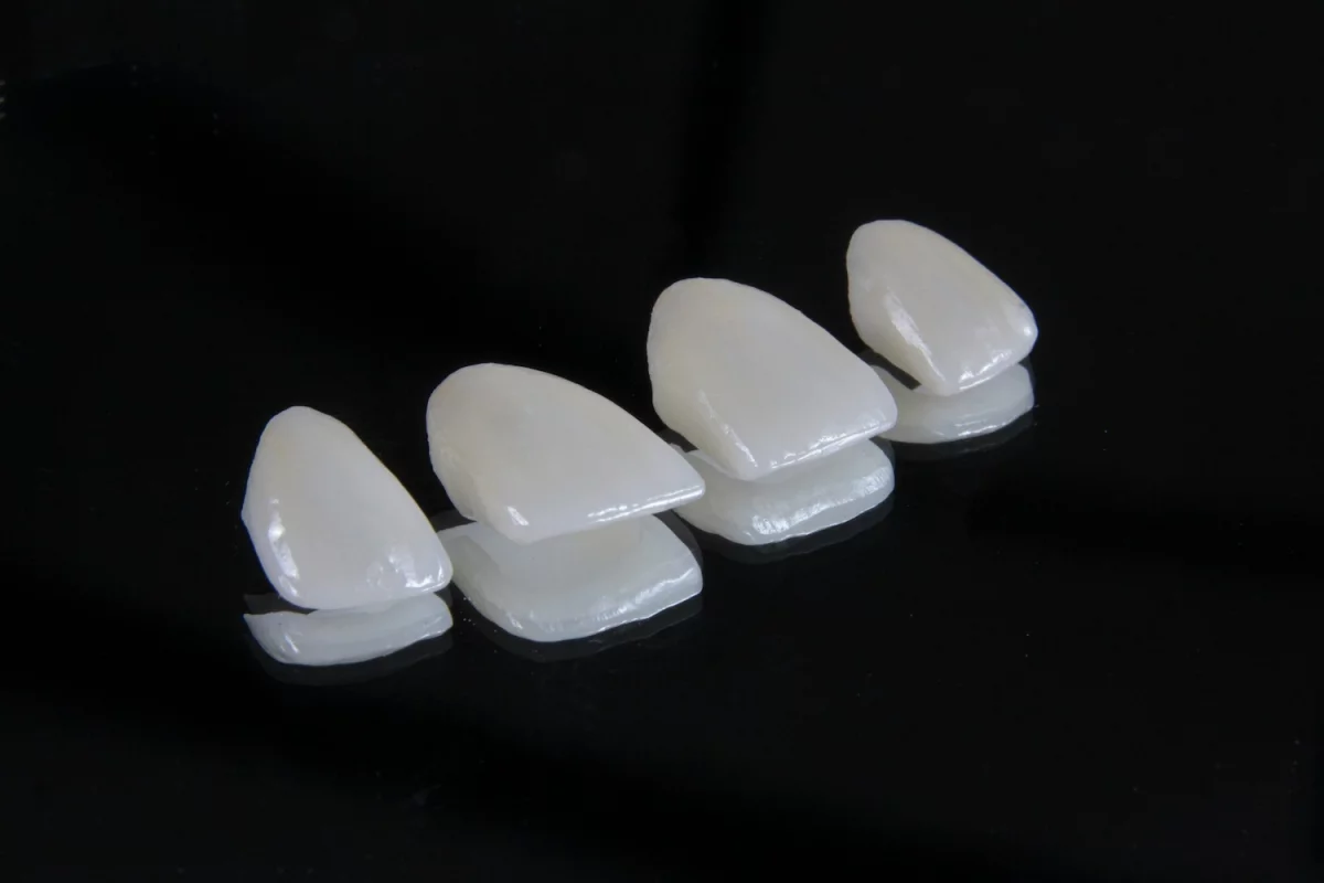 Porcelain Veneers